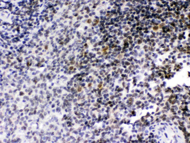 RAG2 Antibody in Immunohistochemistry (Paraffin) (IHC (P))