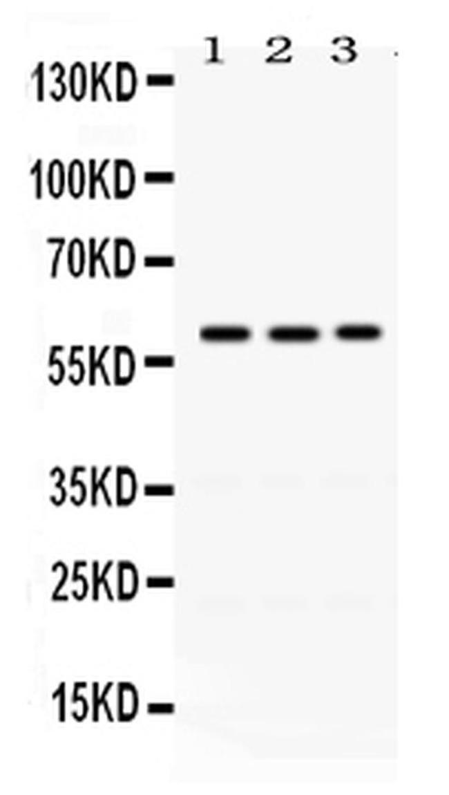 RAG2 Antibody in Western Blot (WB)