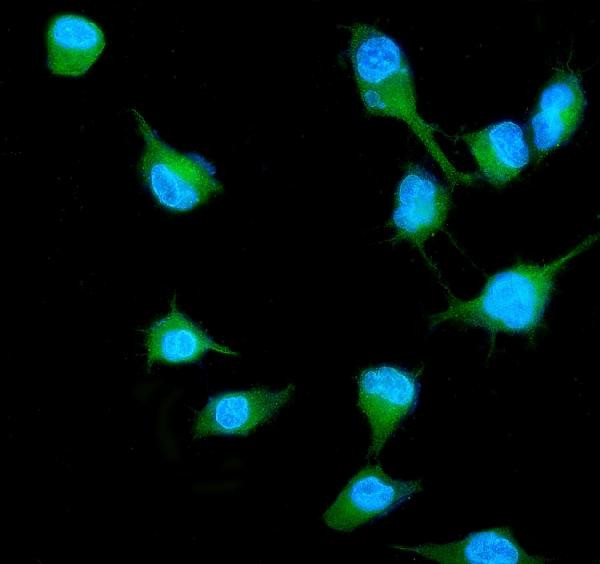 RALB Antibody in Immunocytochemistry (ICC/IF)