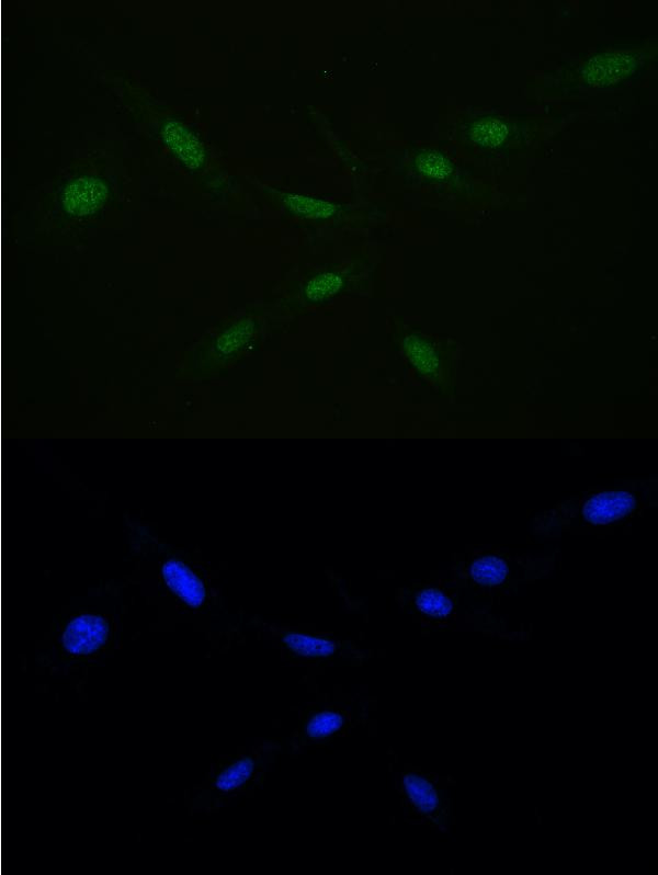 RAN Antibody in Immunocytochemistry (ICC/IF)