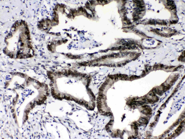 RAN Antibody in Immunohistochemistry (Paraffin) (IHC (P))