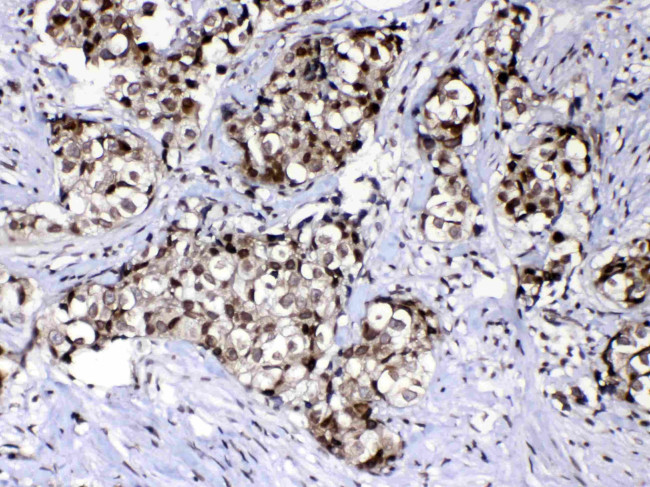 RAN Antibody in Immunohistochemistry (Paraffin) (IHC (P))