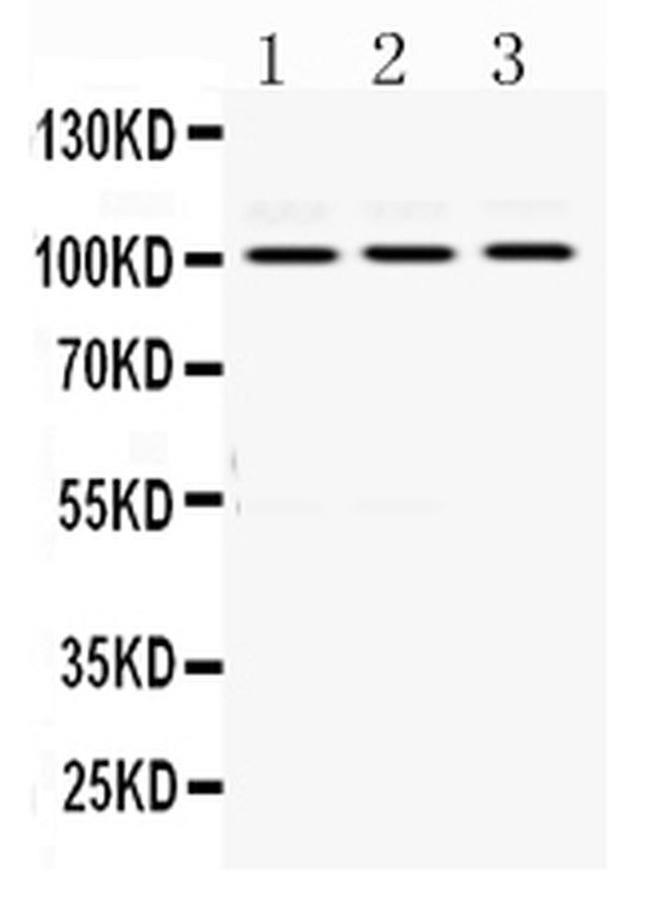 RASA1 Antibody in Western Blot (WB)