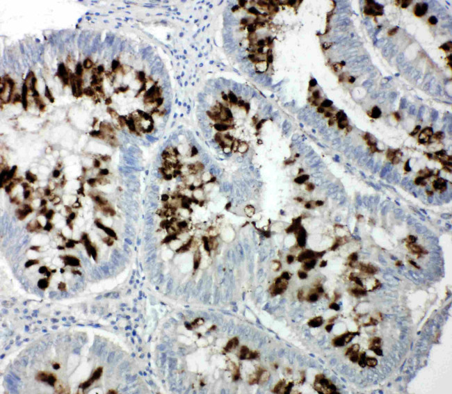 RBL1 Antibody in Immunohistochemistry (Paraffin) (IHC (P))