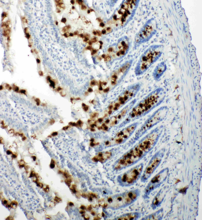 RBL1 Antibody in Immunohistochemistry (Paraffin) (IHC (P))