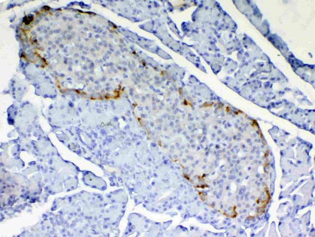 RBP4 Antibody in Immunohistochemistry (Paraffin) (IHC (P))