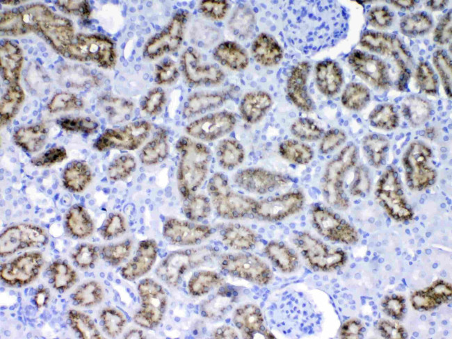 RBP4 Antibody in Immunohistochemistry (Paraffin) (IHC (P))