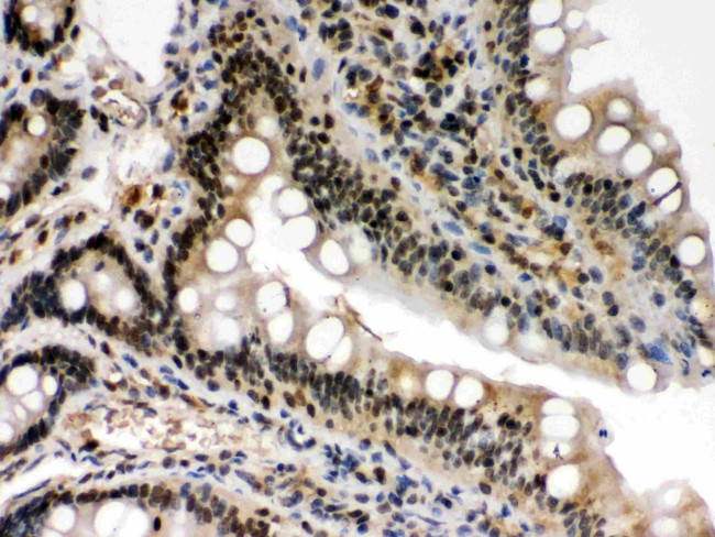 c-Rel Antibody in Immunohistochemistry (Paraffin) (IHC (P))