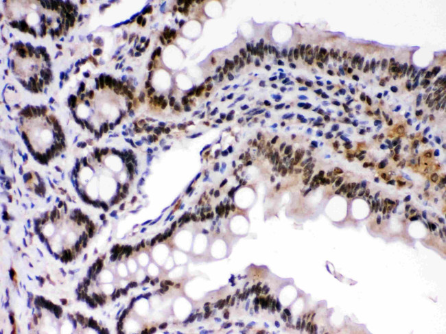 c-Rel Antibody in Immunohistochemistry (Paraffin) (IHC (P))