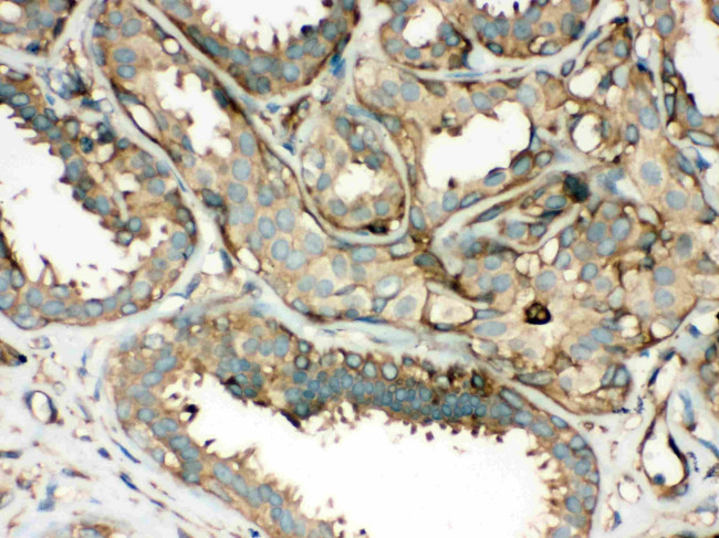 ROCK2 Antibody in Immunohistochemistry (Paraffin) (IHC (P))