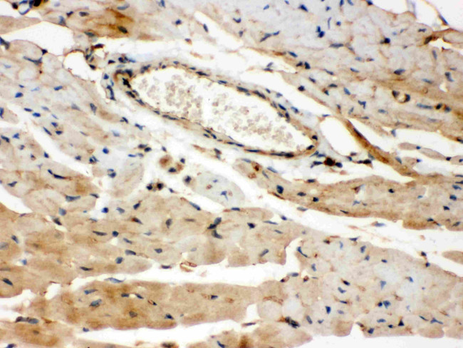 ROCK2 Antibody in Immunohistochemistry (Paraffin) (IHC (P))