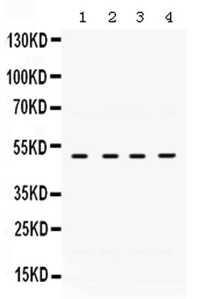 RRM2 Antibody in Western Blot (WB)