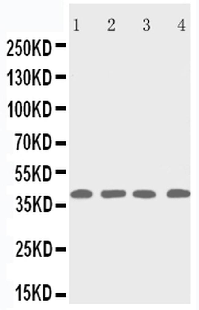 p53R2 Antibody in Western Blot (WB)