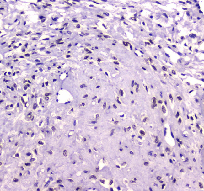 RUNX1T1 Antibody in Immunohistochemistry (Paraffin) (IHC (P))