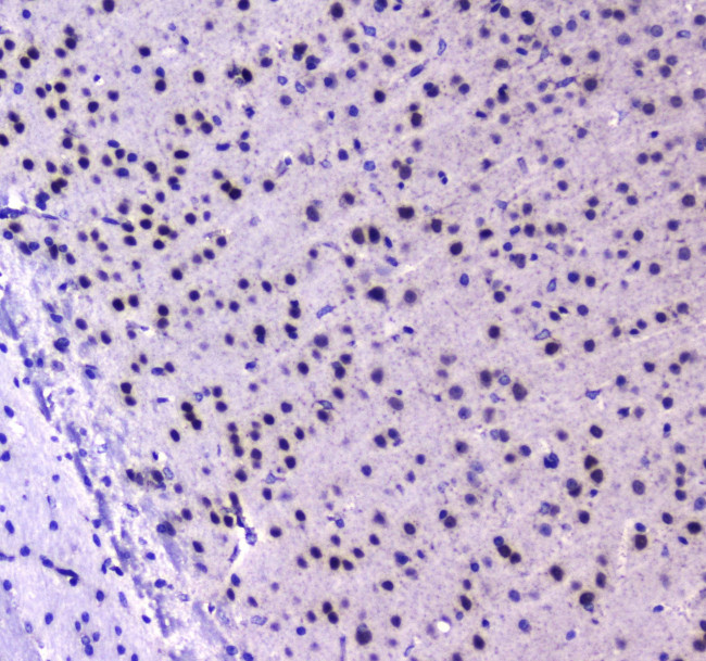 RUNX1T1 Antibody in Immunohistochemistry (Paraffin) (IHC (P))