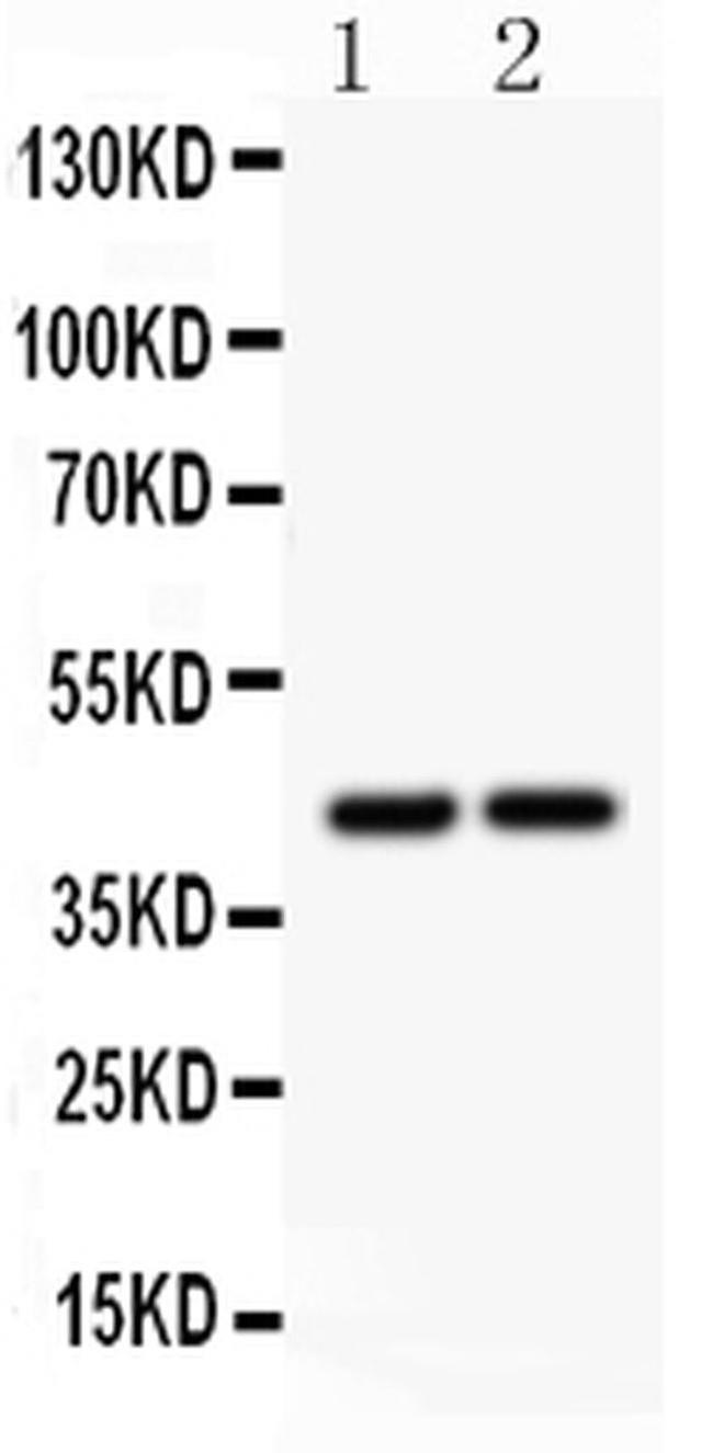 RUNX3 Antibody in Western Blot (WB)