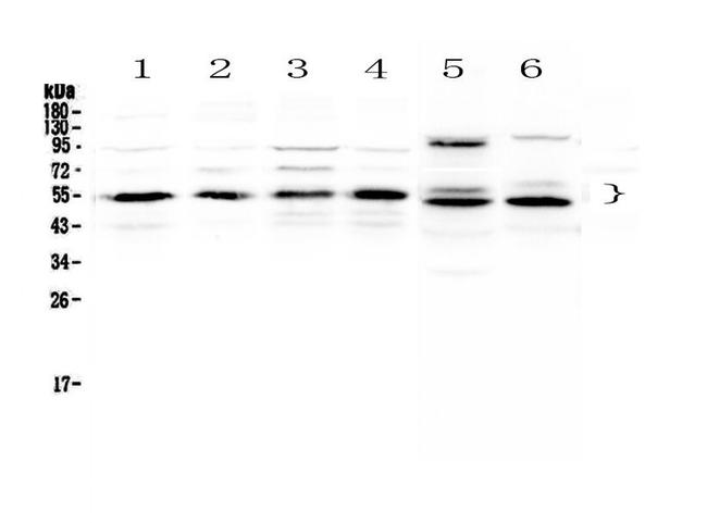 RXRA Antibody in Western Blot (WB)