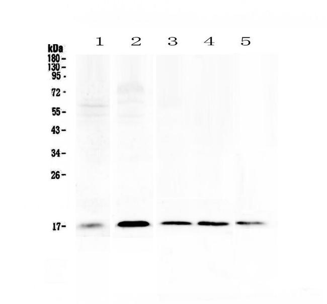 S100A7 Antibody in Western Blot (WB)