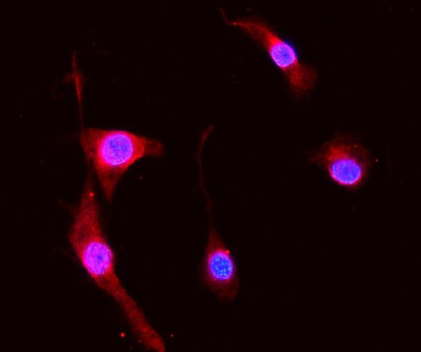 S100A8 Antibody in Immunocytochemistry (ICC/IF)