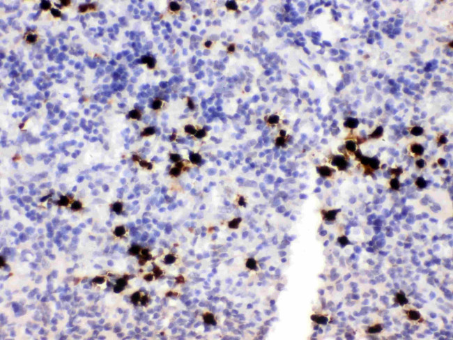 S100A8 Antibody in Immunohistochemistry (Paraffin) (IHC (P))