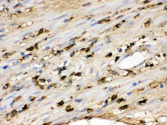 S100A9 Antibody in Immunohistochemistry (Paraffin) (IHC (P))