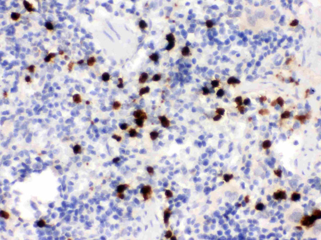 S100A9 Antibody in Immunohistochemistry (Paraffin) (IHC (P))