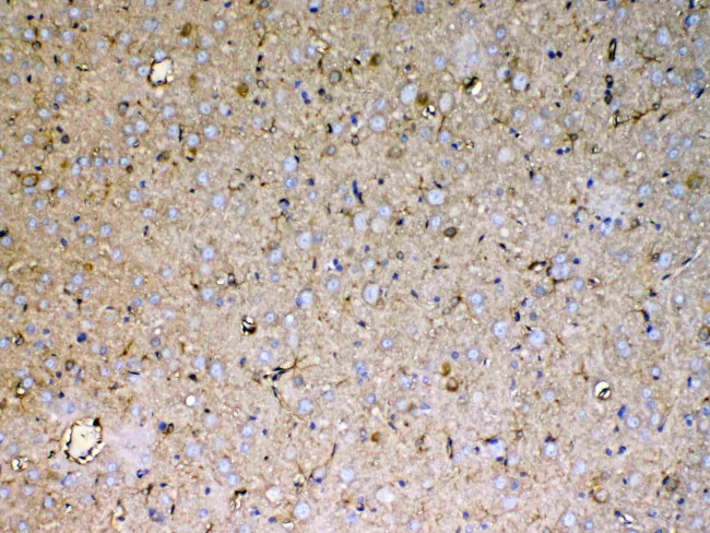 Sacsin Antibody in Immunohistochemistry (Paraffin) (IHC (P))