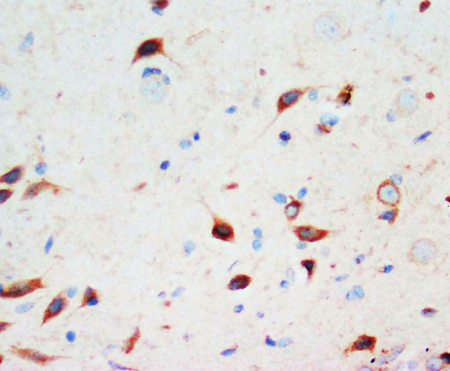 SCG3 Antibody in Immunohistochemistry (Paraffin) (IHC (P))