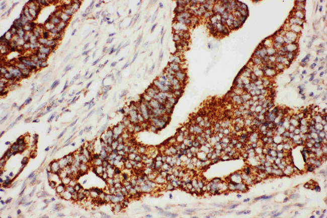 SCG3 Antibody in Immunohistochemistry (Paraffin) (IHC (P))