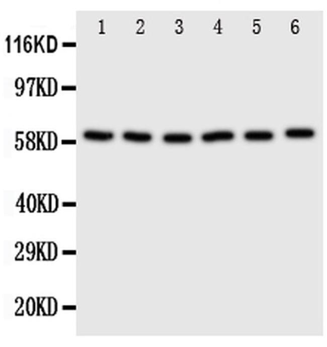 SCLY Antibody in Western Blot (WB)