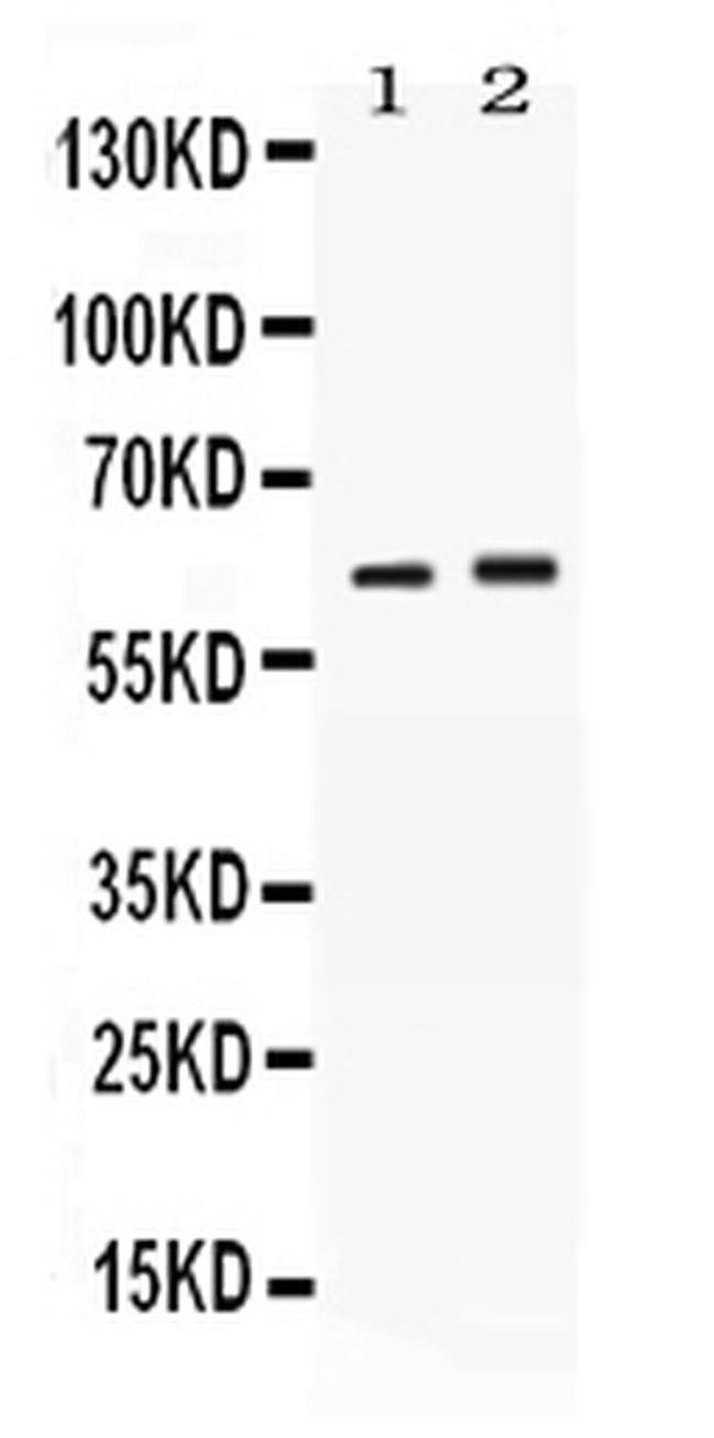 SCTR Antibody in Western Blot (WB)