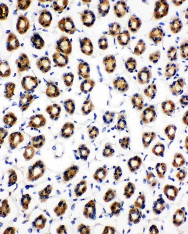 SDHC Antibody in Immunohistochemistry (Paraffin) (IHC (P))