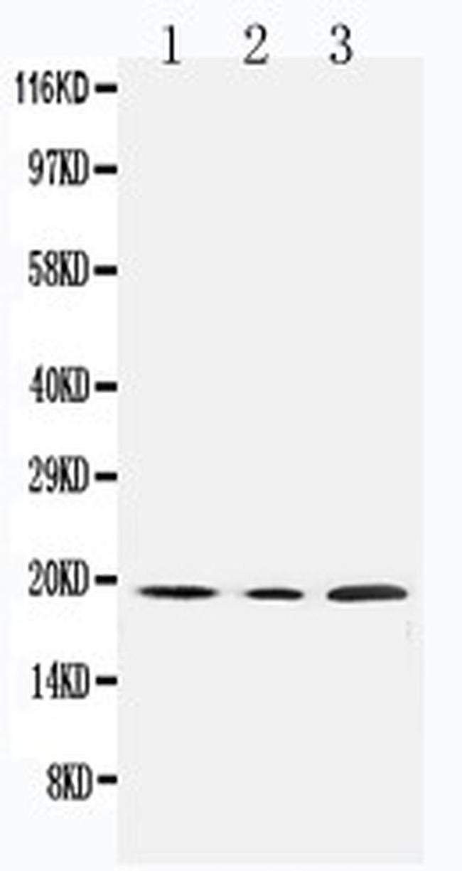 SDHC Antibody in Western Blot (WB)