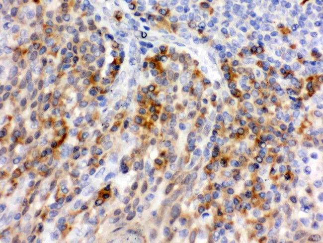 P-Selectin (CD62P) Antibody in Immunohistochemistry (Paraffin) (IHC (P))