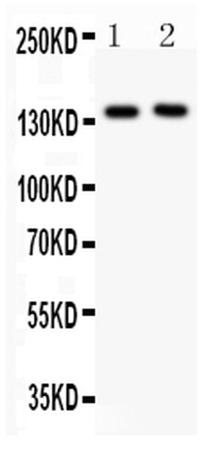 P-Selectin (CD62P) Antibody in Western Blot (WB)