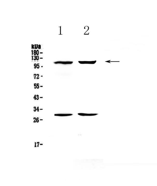 P-Selectin (CD62P) Antibody in Western Blot (WB)