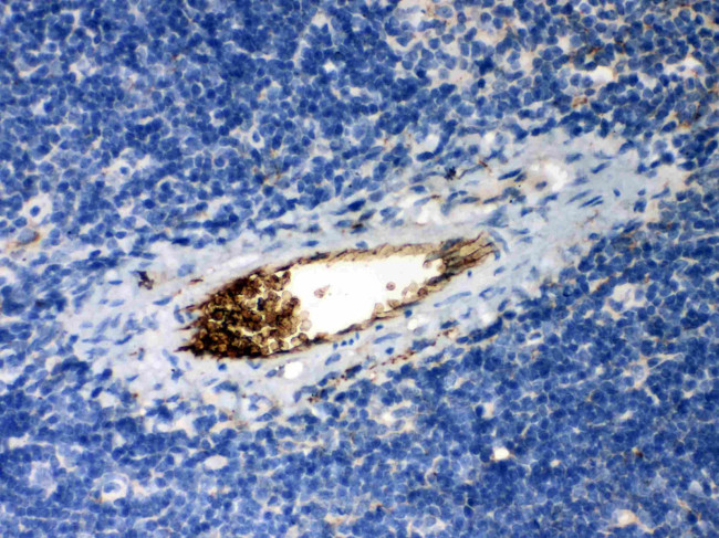 alpha-1 Antitrypsin Antibody in Immunohistochemistry (Paraffin) (IHC (P))