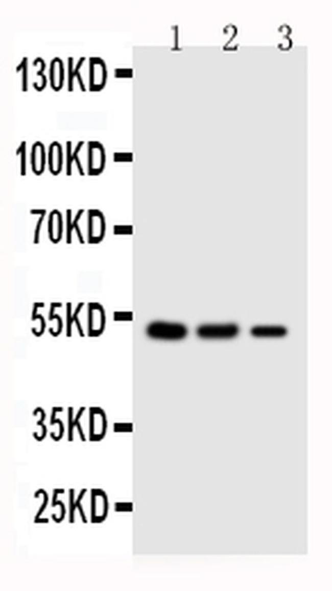 Kallistatin Antibody in Western Blot (WB)