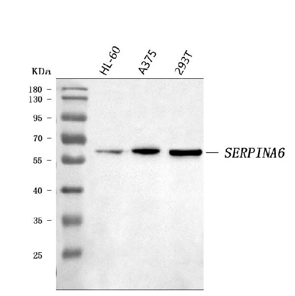 SERPINA6 Antibody in Western Blot (WB)