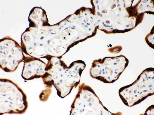 SERPINB2 Antibody in Immunohistochemistry (Paraffin) (IHC (P))