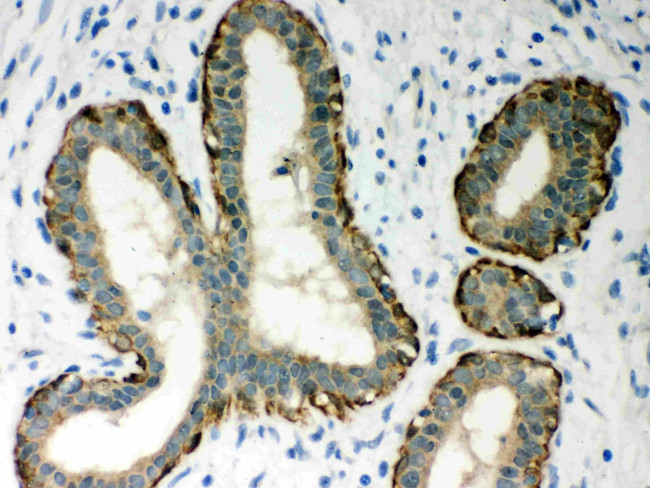 Maspin Antibody in Immunohistochemistry (Paraffin) (IHC (P))