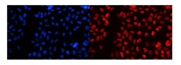 SF1 Antibody in Immunocytochemistry (ICC/IF)