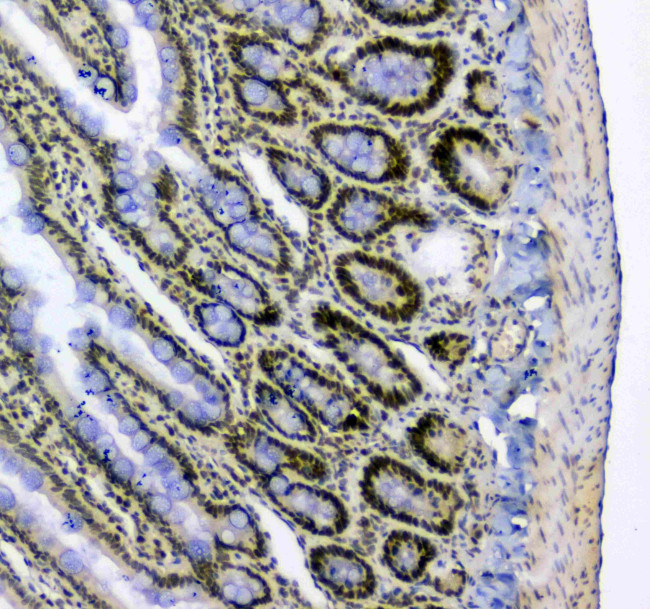 SF1 Antibody in Immunohistochemistry (Paraffin) (IHC (P))