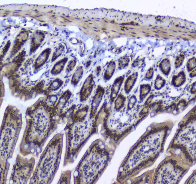 SF1 Antibody in Immunohistochemistry (Paraffin) (IHC (P))