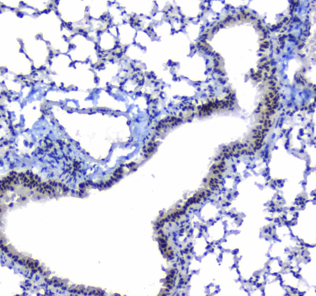 SF1 Antibody in Immunohistochemistry (Paraffin) (IHC (P))