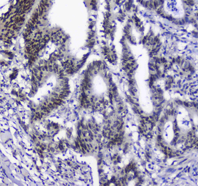 SF1 Antibody in Immunohistochemistry (Paraffin) (IHC (P))