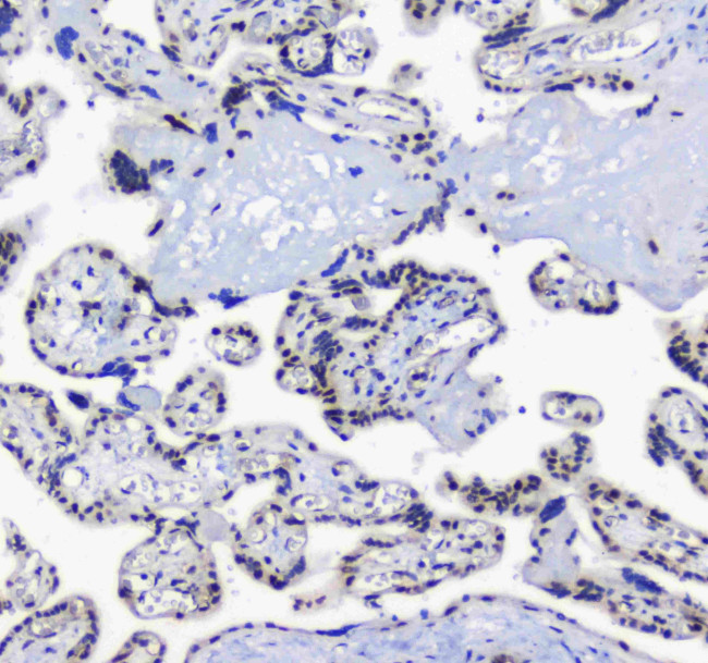 SF1 Antibody in Immunohistochemistry (Paraffin) (IHC (P))