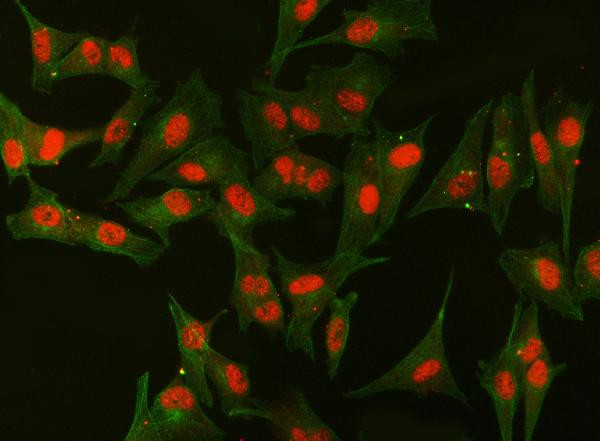 SF1 Antibody in Immunocytochemistry (ICC/IF)