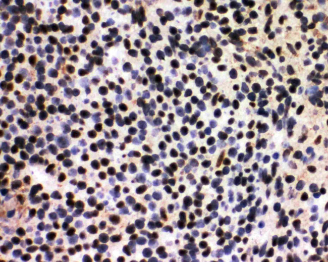 SF1 Antibody in Immunohistochemistry (Frozen) (IHC (F))