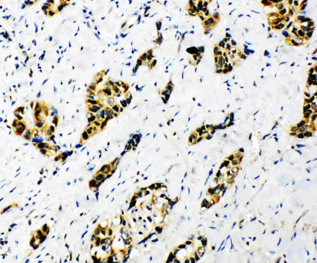 SF1 Antibody in Immunohistochemistry (Paraffin) (IHC (P))